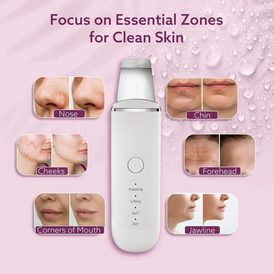 SkinVibe™ Ultrasonic Dermal Cleanser