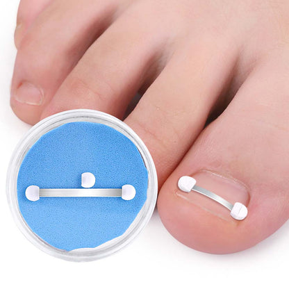 Ingrown Toenail Correction Bands