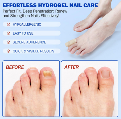 Fungal Nail Repair Patches