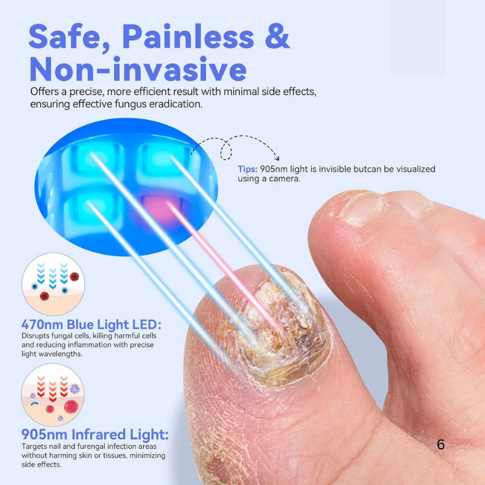 Nail Fungus Cleaning Device With LED Display Pro