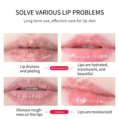 Hydrating Collagen Lip Patches (30 Pcs)