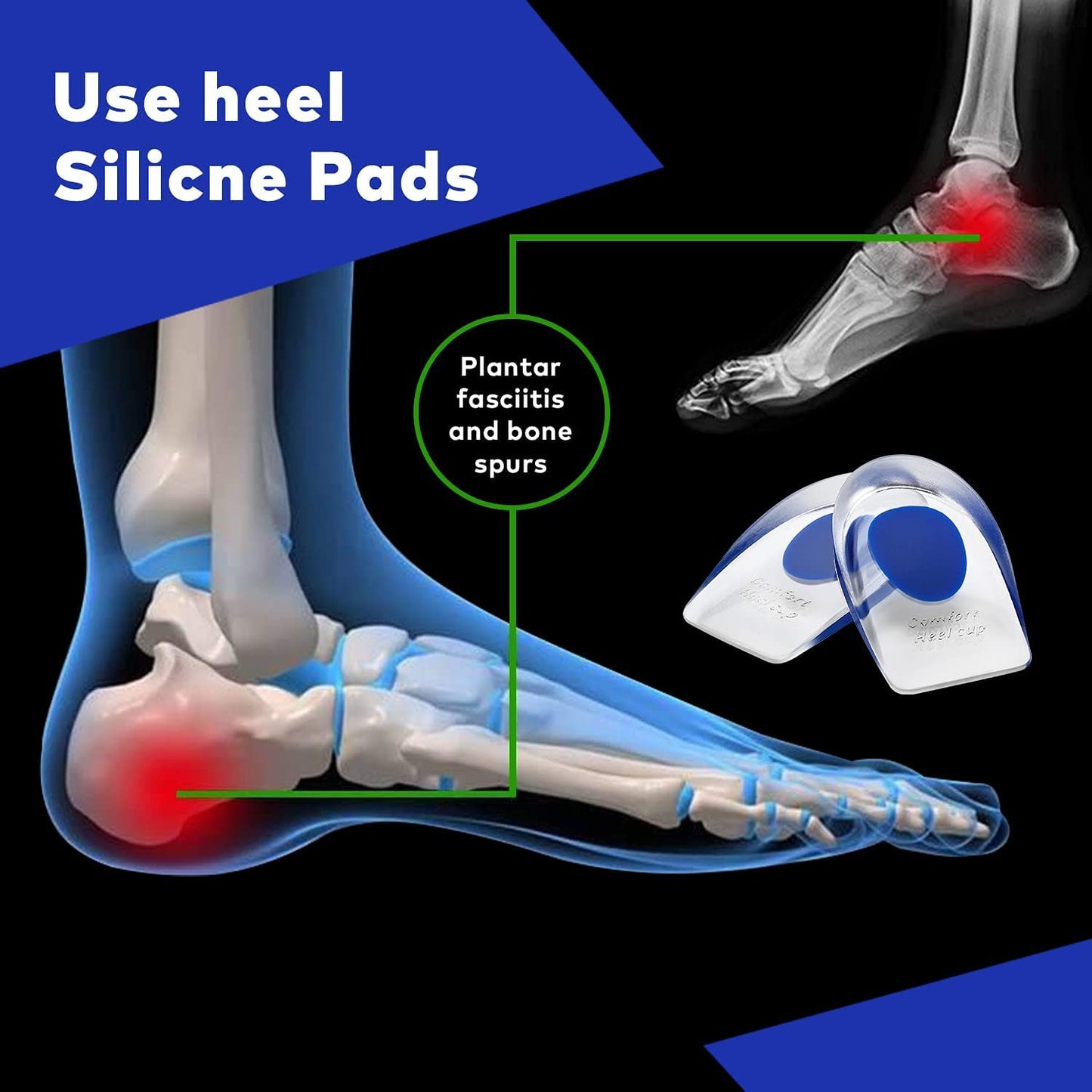 Silicone Shoes Insoles (Pair Of 2)