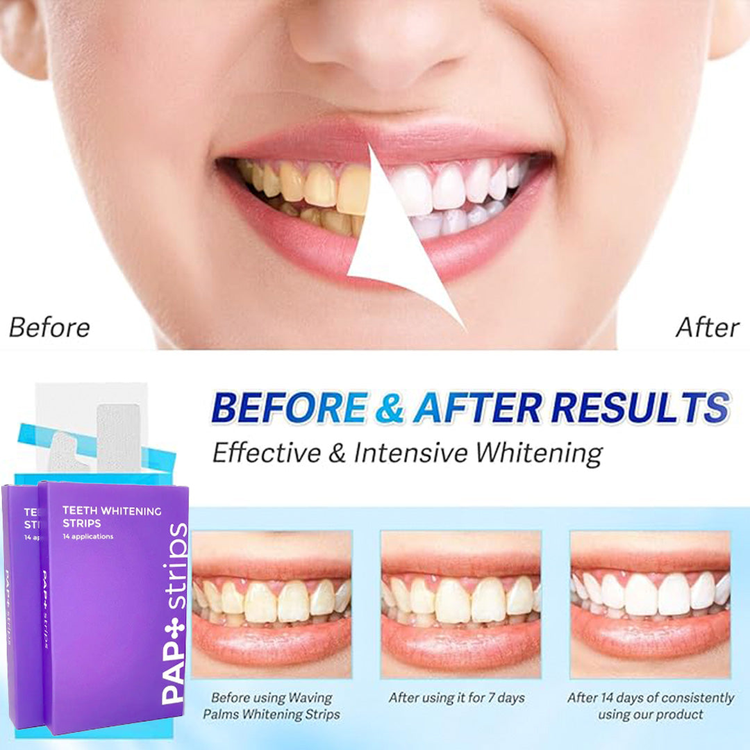 Teeth Whitening Strips (14 Pair)