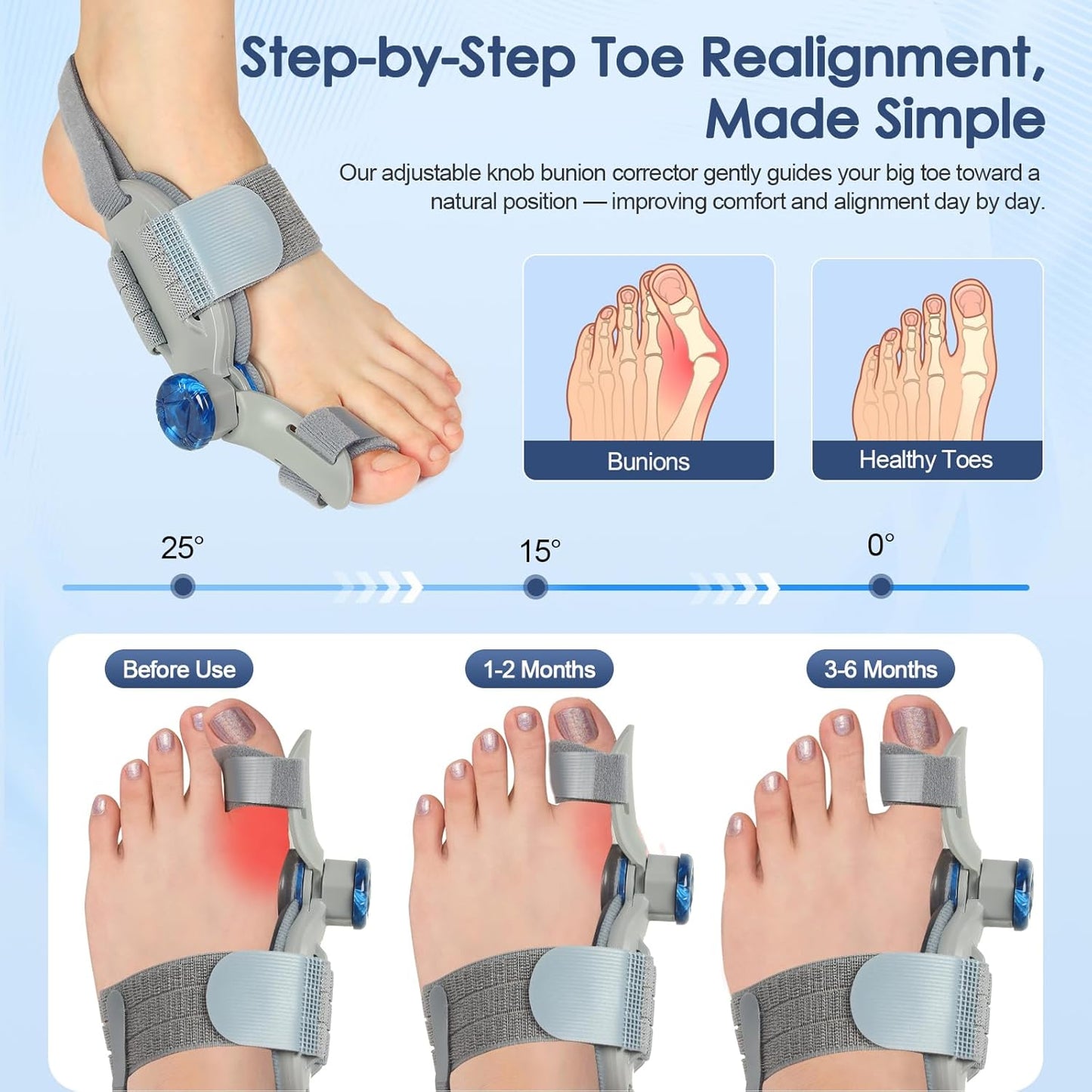 Bunion Corrector for Women & Men Big Toe