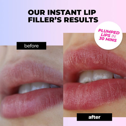 Microneedle Lip Plumping Patch