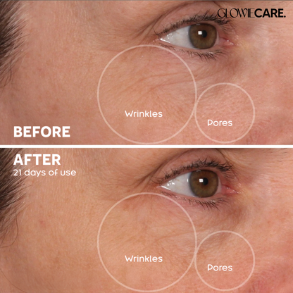 Micro-Glow Facial Enhancement Device