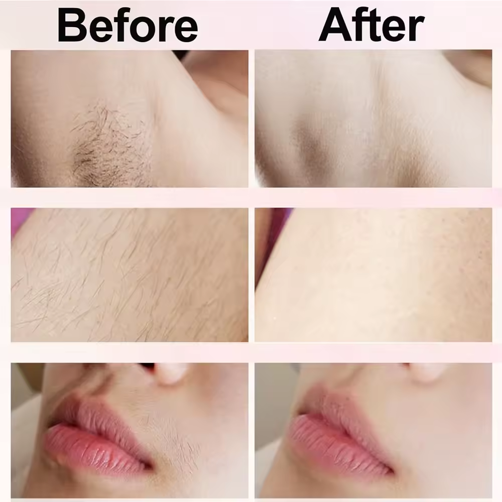 SkinVibe™ Electric Shaver for Women