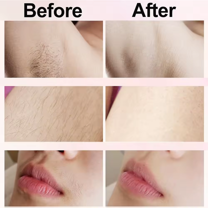 SkinVibe™ Electric Shaver for Women