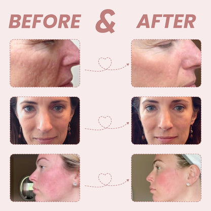 Micro-Glow Facial Enhancement Device