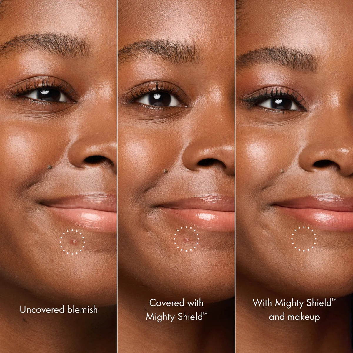 Invisible Liquid Blemish Patch for Pimples Cover