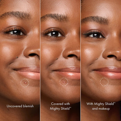 Invisible Liquid Blemish Patch for Pimples Cover