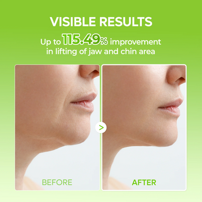 V-Line Double Chin Lifting Mask (Pack of 5)
